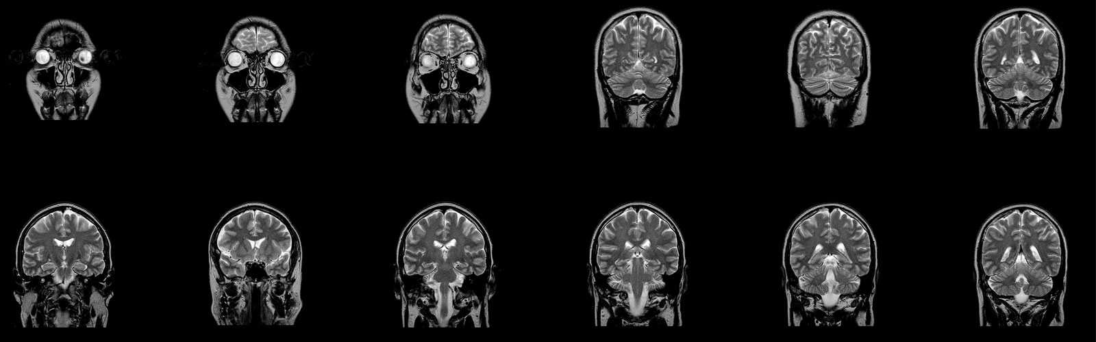 neuroimaging